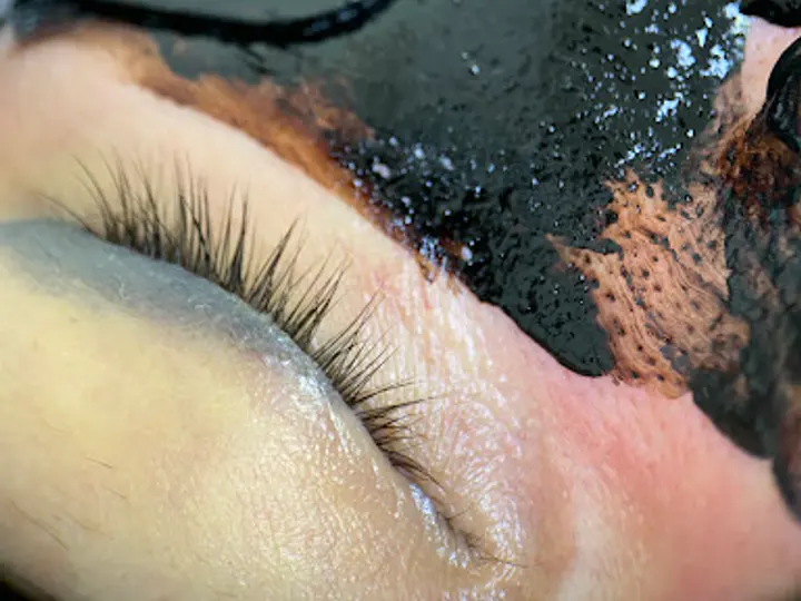 Allure Aesthetic Clinic in Limerick