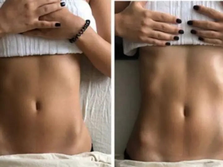 Body Sculpt Kildare in Kildare