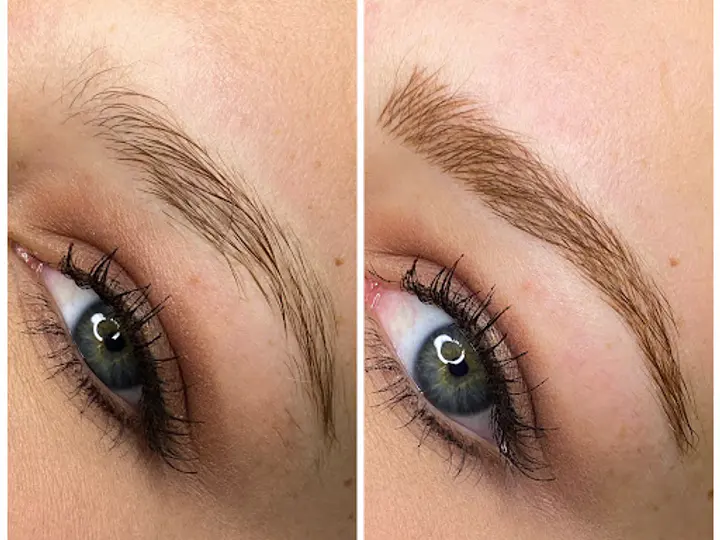 Face Forward Aesthetics Clinic in Kilcock